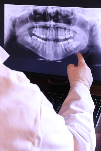 Best Emergency Treatment for Toothache in Pineville, LA