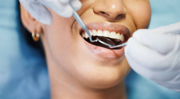 Best After-Hours Emergency Dentist in Pineville, LA